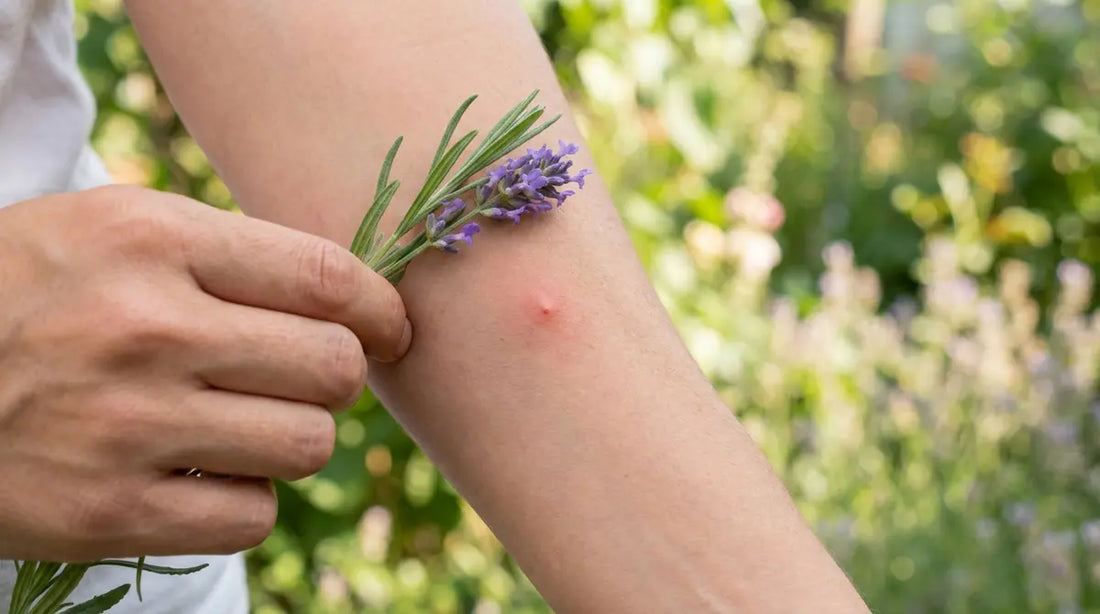 Comment apaiser les piqûres de moustiques ?